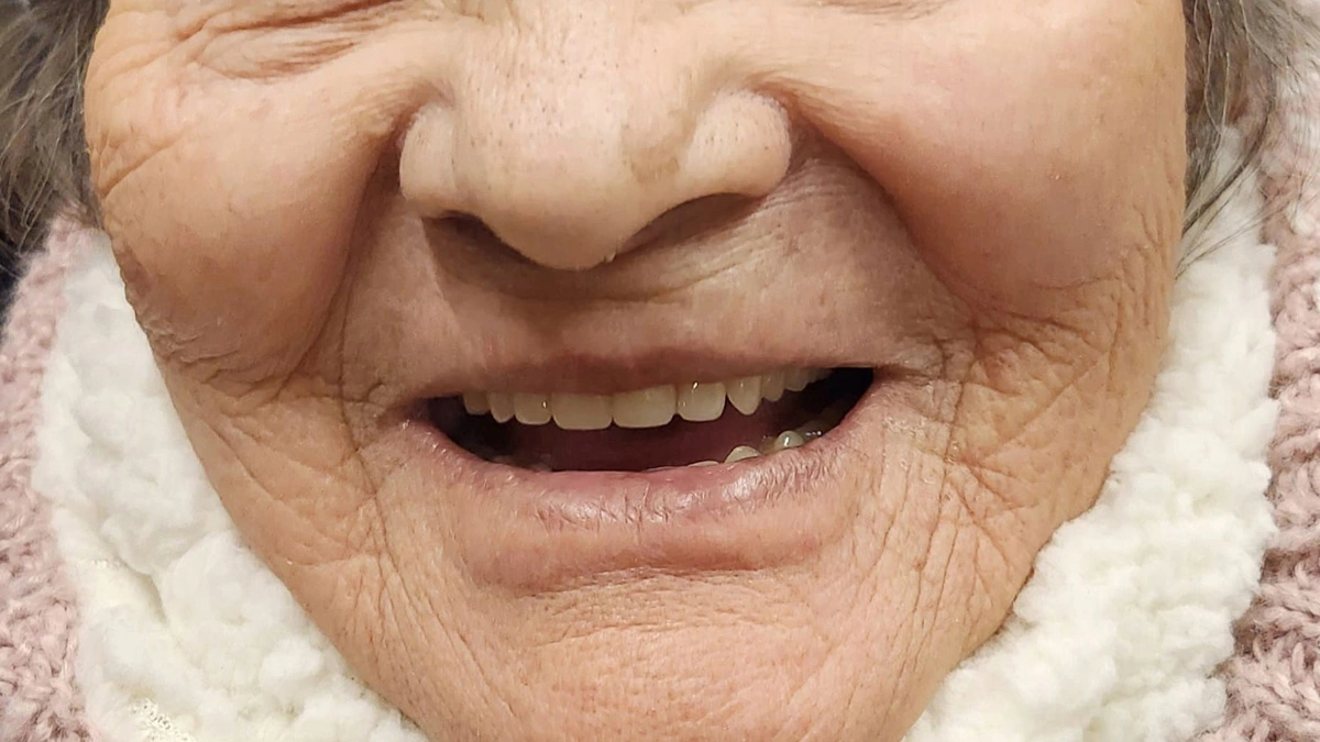 Clinical case: dental restoration 1